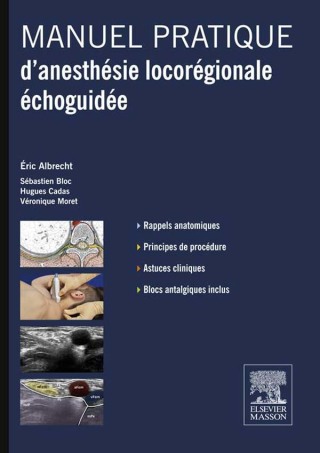 Cover image: Manuel pratique d’anesthésie locorégionale échoguidée 9782294716041