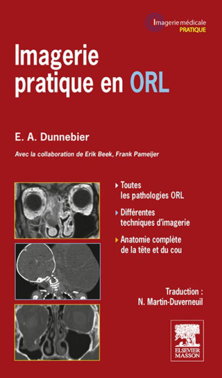 Cover image: Imagerie pratique en ORL 9782294715662