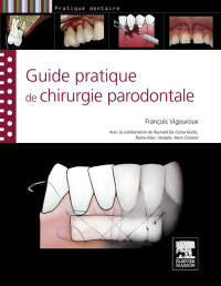 Immagine di copertina: Guide pratique de chirurgie parodontale 9782294714467