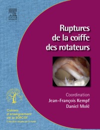 Cover image: Ruptures de la coiffe des rotateurs 9782294713187