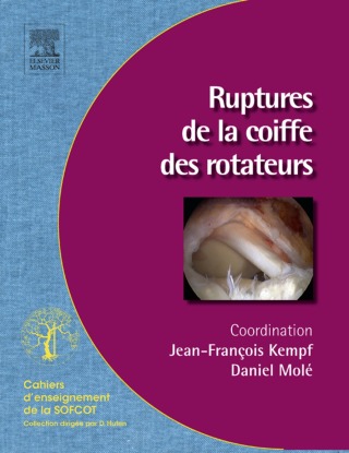 Titelbild: Ruptures de la coiffe des rotateurs 9782294713187