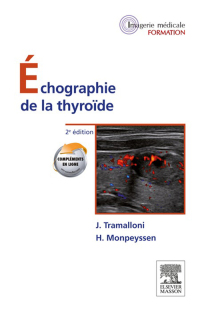 Cover image: Échographie de la thyroïde 2nd edition 9782294711282