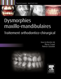 表紙画像: Dysmorphies maxillo-mandibulaires 9782294710070