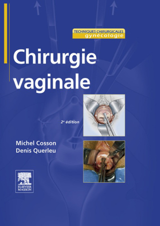 Titelbild: Chirurgie vaginale 2nd edition 9782294097195