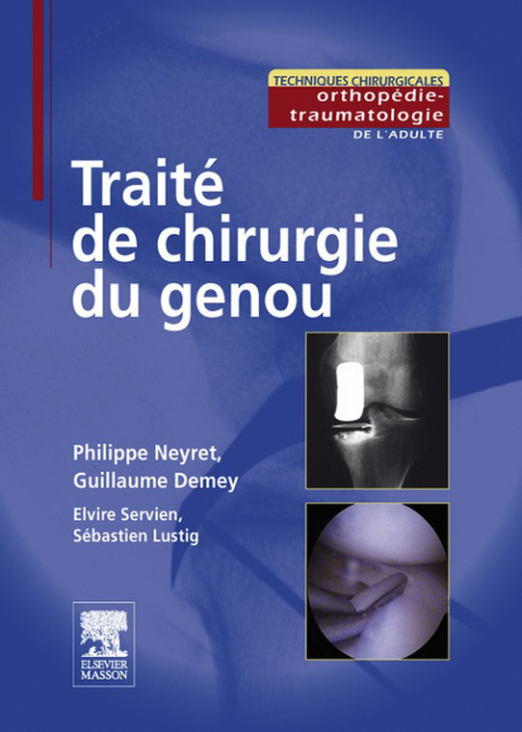 Traité de chirurgie du genou - FULL INSTANT DOWNLOAD | PDF DOCX EPUB