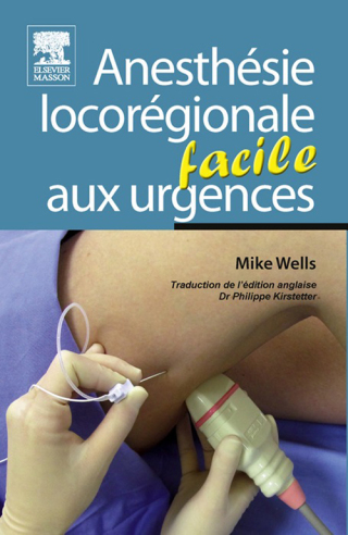 Cover image: Anesthésie locorégionale facile aux urgences 9782294713606