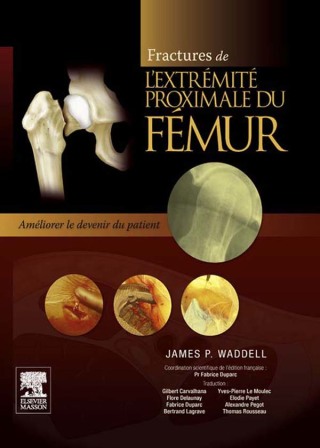 Cover image: Fractures de l'extrémité proximale du fémur 9782294715327