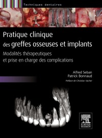表紙画像: Pratique clinique des greffes osseuses et implants 9782294710131