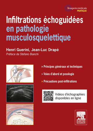 Cover image: Infiltrations échoguidées 9782294715860