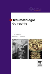 Immagine di copertina: Traumatologie du rachis 9782294705991