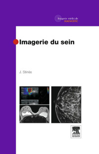 Cover image: Imagerie du sein 9782294715112