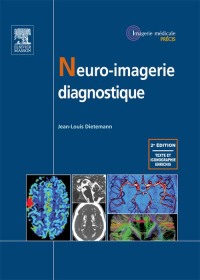 Imagen de portada: Neuro-imagerie diagnostique 2nd edition 9782294714528