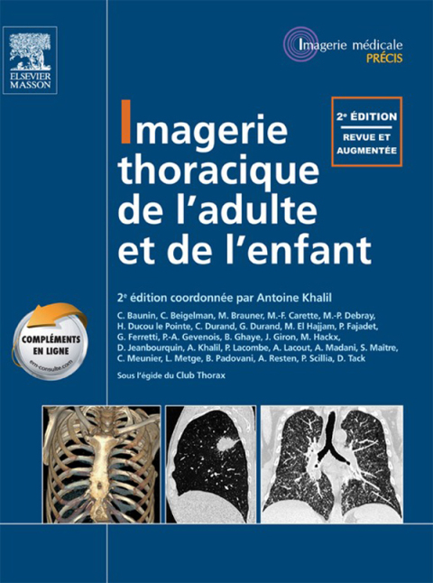 Imagerie thoracique de l'enfant et de l'adulte, 2nd Edition - FULL INSTANT DOWNLOAD | PDF DOCX EPUB