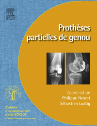 Immagine di copertina: Prothèses partielles du genou 9782294714573