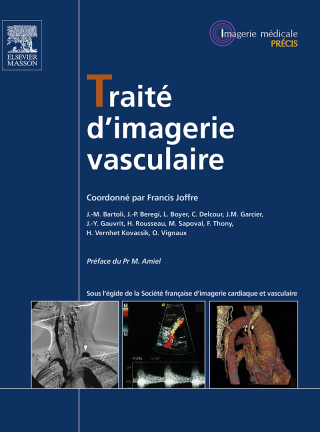 Immagine di copertina: Traité d'imagerie vasculaire 9782294714856