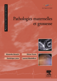 Titelbild: Pathologies maternelles et grossesse 9782294713309