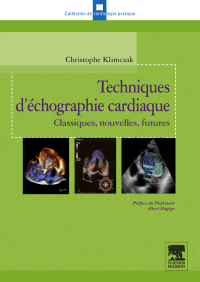 Cover image: Techniques d'échographie cardiaque 9782294706066
