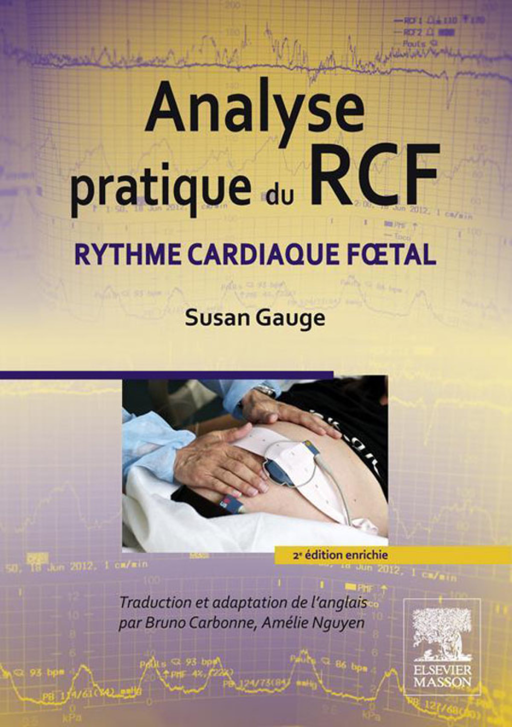 Analyse pratique du RCF Rythme cardiaque fœtal 2nd Edition
