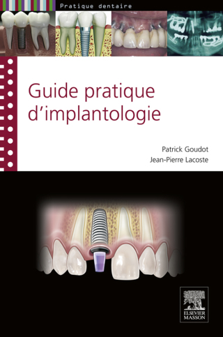 Cover image: guide pratique d'implantologie 1st edition 9782294730856