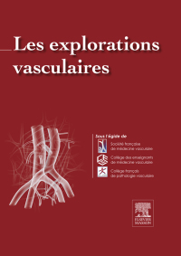 Omslagafbeelding: Les Explorations vasculaires 9782294735448