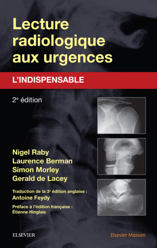 Immagine di copertina: Lecture radiologique aux urgences : l'indispensable 2nd edition 9782294735110
