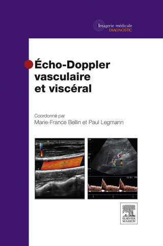 Cover image: Echo-Doppler vasculaire et viscéral 9782294719479