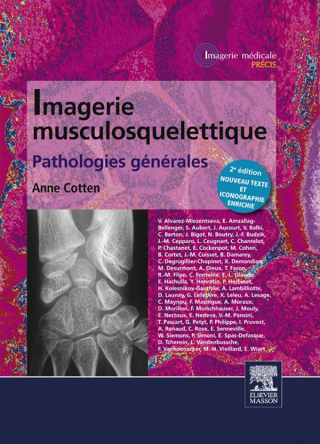Cover image: Imagerie musculosquelettique : pathologies générales 2nd edition 9782294719240