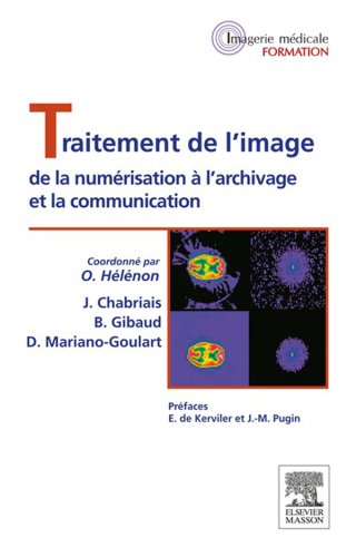 Cover image: Traitement de l'image 9782294736858