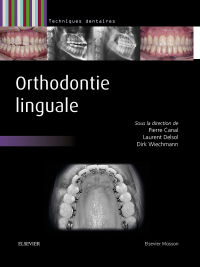 Cover image: Orthodontie linguale 9782294734304