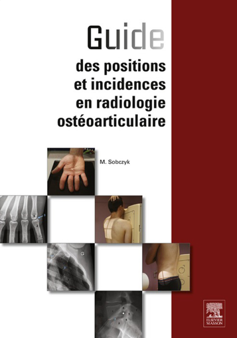 Guide des positions et incidences en radiologie ostéoarticulaire - FULL INSTANT DOWNLOAD | PDF DOCX EPUB