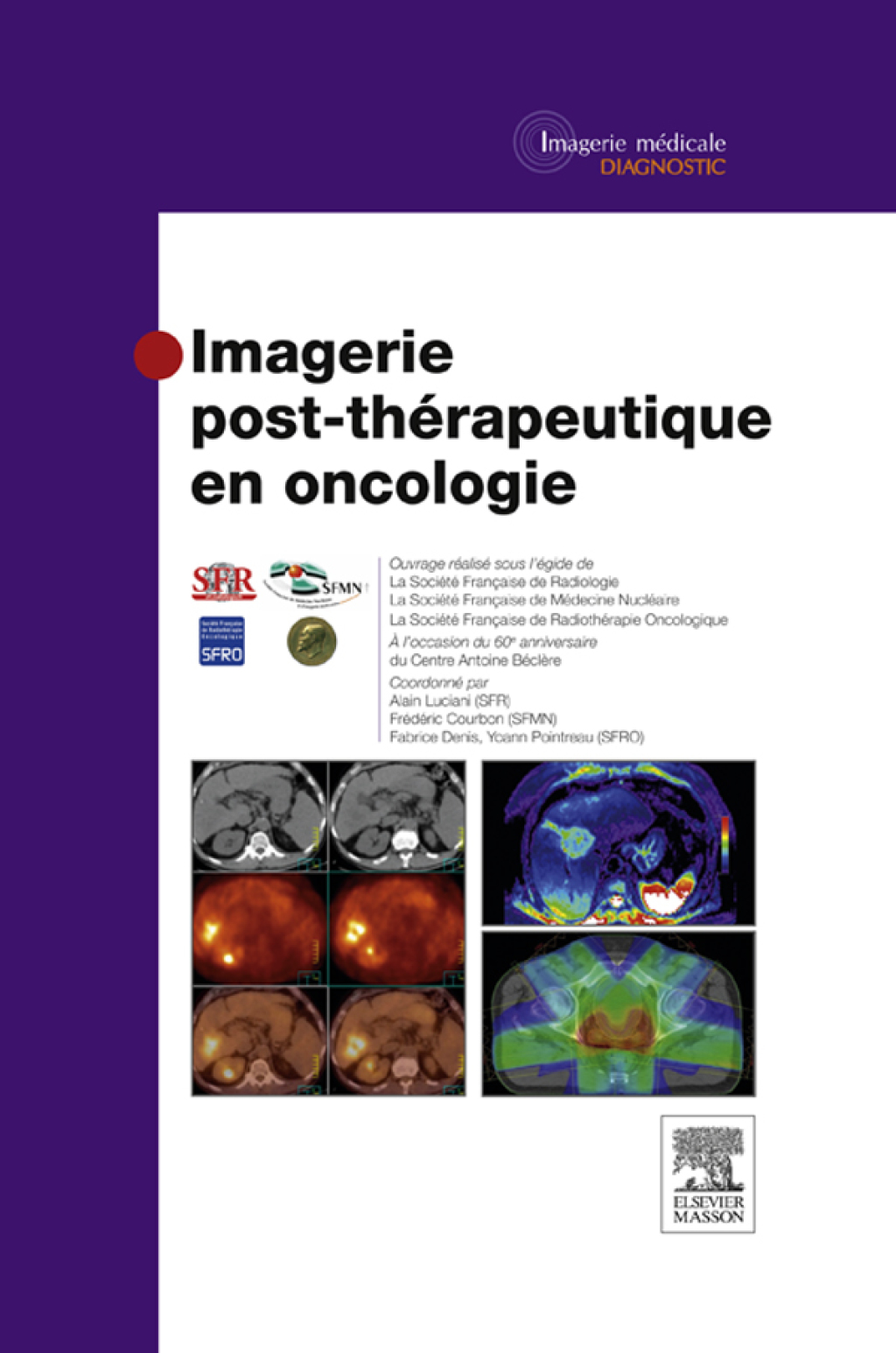 Imagerie post-thérapeutique en oncologie 1st Edition