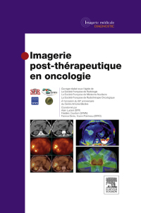 Titelbild: Imagerie post-thérapeutique en oncologie 1st edition 9782294738401