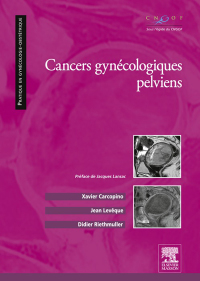 Cover image: Cancers gynécologiques pelviens 9782294729379