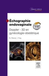 Omslagafbeelding: Échographie endovaginale Doppler - 3D 6th edition 9782294724282