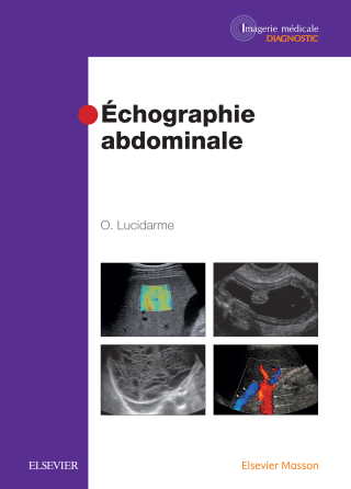 表紙画像: Echographie abdominale 9782294734137