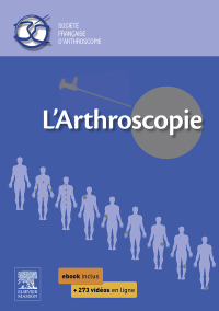 Imagen de portada: L'arthroscopie 1st edition 9782294743542