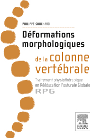 Cover image: Déformations morphologiques de la colonne vertébrale 9782294744501