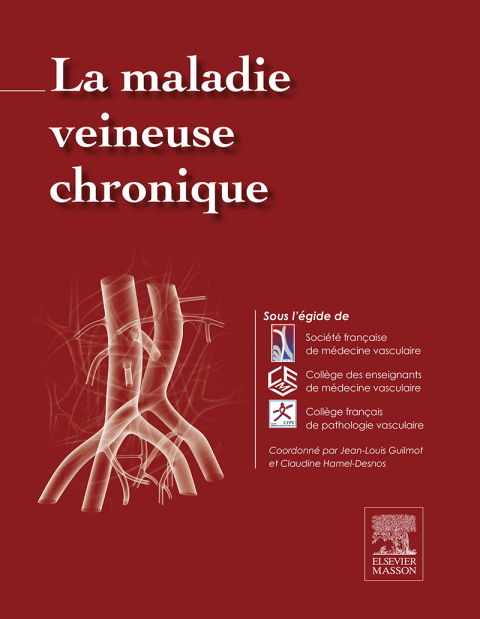 La maladie veineuse chronique - FULL INSTANT DOWNLOAD | PDF DOCX EPUB