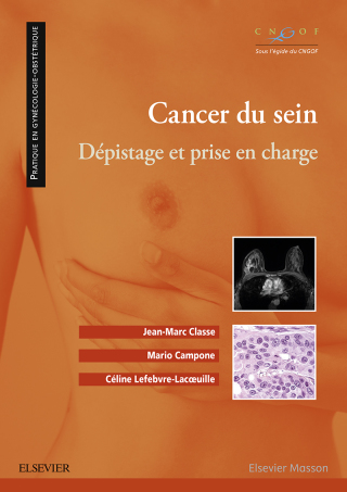 Cover image: Cancer du sein 9782294744495
