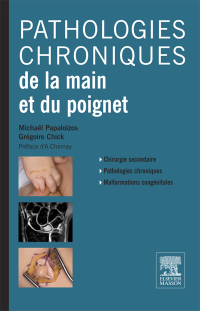 Cover image: Pathologies chroniques de la main et du poignet 9782294743245