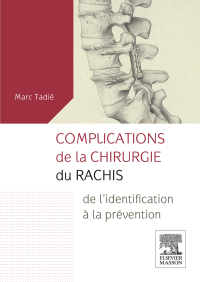 Imagen de portada: Complications de la chirurgie du rachis 9782294745621