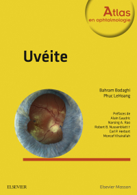 Cover image: Uvéite 2nd edition 9782294744686