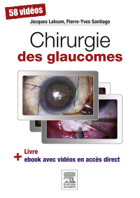 Omslagafbeelding: Chirurgie des glaucomes 9782294743757