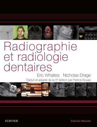 Cover image: Radiographie et radiologie dentaires 9782294743528