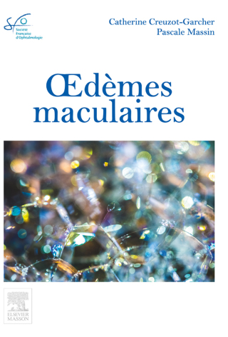 Cover image: Oedèmes maculaires 9782294749490