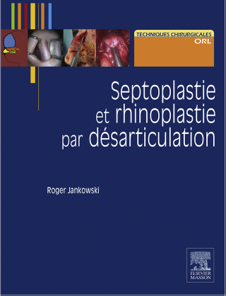 Cover image: Septoplastie et rhinoplastie par désarticulation 9782294750007
