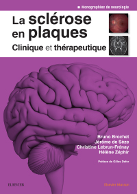 Cover image: La sclérose en plaques - Clinique et thérapeutique 9782294750205