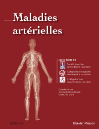 Cover image: Maladies artérielles 9782294749704