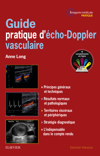 Cover image: Guide pratique d'écho-Doppler vasculaire 9782294751196