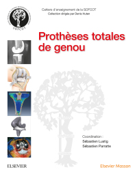 Immagine di copertina: Prothèses totales de genou 9782294749162